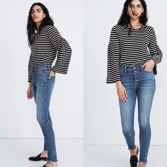 Madewell Denim - Madewell High Rise Skinny Jeans Button Front